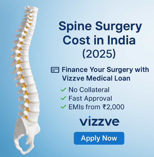 Spine Surgery Cost in India (2025) – Finance Your Operation Easily with a Vizzve Medical Loan